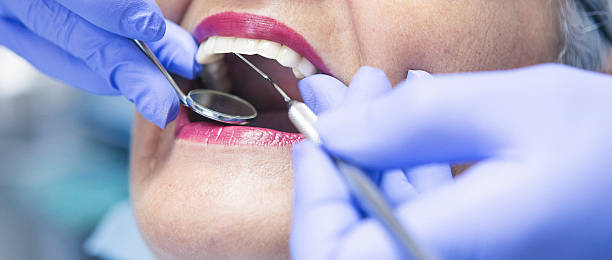 Best Emergency Dentist for Knocked-Out Tooth in Larkfield Wikiup, CA